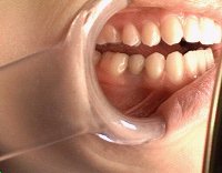 teeth exam